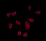 SULT1E1 Antibody in Immunocytochemistry (ICC/IF)