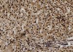 SULT1E1 Antibody in Immunohistochemistry (Paraffin) (IHC (P))