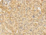 SULT1E1 Antibody in Immunohistochemistry (Paraffin) (IHC (P))