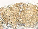 SULT1E1 Antibody in Immunohistochemistry (Paraffin) (IHC (P))