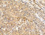 SULT1E1 Antibody in Immunohistochemistry (Paraffin) (IHC (P))