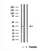 SULT1E1 Antibody in Western Blot (WB)