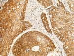 TELO2 Antibody in Immunohistochemistry (Paraffin) (IHC (P))