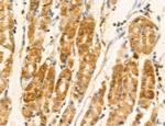 TELO2 Antibody in Immunohistochemistry (Paraffin) (IHC (P))