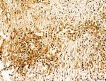 TELO2 Antibody in Immunohistochemistry (Paraffin) (IHC (P))