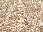 TELO2 Antibody in Immunohistochemistry (Paraffin) (IHC (P))