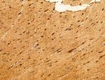 TELO2 Antibody in Immunohistochemistry (Paraffin) (IHC (P))