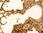 TELO2 Antibody in Immunohistochemistry (Paraffin) (IHC (P))