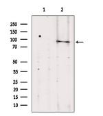 TELO2 Antibody in Western Blot (WB)