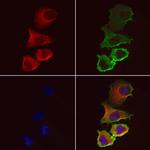 ACSL4 Antibody in Immunocytochemistry (ICC/IF)