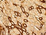 ACSL4 Antibody in Immunohistochemistry (Paraffin) (IHC (P))