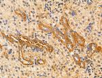 ACSL4 Antibody in Immunohistochemistry (Paraffin) (IHC (P))