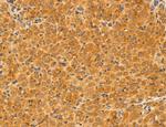 ACSL4 Antibody in Immunohistochemistry (Paraffin) (IHC (P))