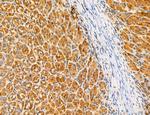 ACSL4 Antibody in Immunohistochemistry (Paraffin) (IHC (P))