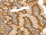 ACSL4 Antibody in Immunohistochemistry (Paraffin) (IHC (P))