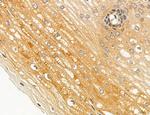 ACSL4 Antibody in Immunohistochemistry (Paraffin) (IHC (P))