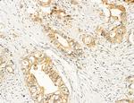 ACSL4 Antibody in Immunohistochemistry (Paraffin) (IHC (P))