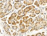 ACSL4 Antibody in Immunohistochemistry (Paraffin) (IHC (P))