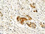 ACSL4 Antibody in Immunohistochemistry (Paraffin) (IHC (P))