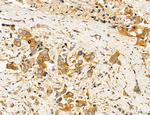 ACSL4 Antibody in Immunohistochemistry (Paraffin) (IHC (P))