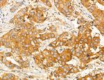 ACSL4 Antibody in Immunohistochemistry (Paraffin) (IHC (P))