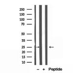 ATP Synthase B1 Antibody in Western Blot (WB)