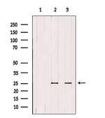 ATP Synthase B1 Antibody in Western Blot (WB)