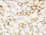 ATP Synthase B1 Antibody in Immunohistochemistry (Paraffin) (IHC (P))