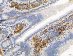 ATP Synthase B1 Antibody in Immunohistochemistry (Paraffin) (IHC (P))