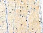 CAPZA1 Antibody in Immunohistochemistry (Paraffin) (IHC (P))