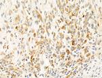 CAPZA1 Antibody in Immunohistochemistry (Paraffin) (IHC (P))