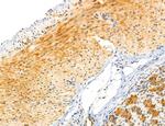 CAPZA1 Antibody in Immunohistochemistry (Paraffin) (IHC (P))