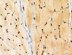 AGTPBP1 Antibody in Immunohistochemistry (Paraffin) (IHC (P))