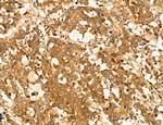 AGTPBP1 Antibody in Immunohistochemistry (Paraffin) (IHC (P))