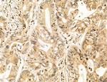 AGTPBP1 Antibody in Immunohistochemistry (Paraffin) (IHC (P))