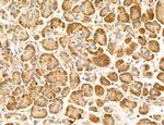 AGTPBP1 Antibody in Immunohistochemistry (Paraffin) (IHC (P))