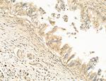 AGTPBP1 Antibody in Immunohistochemistry (Paraffin) (IHC (P))