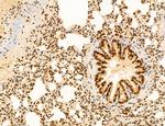 AGTPBP1 Antibody in Immunohistochemistry (Paraffin) (IHC (P))