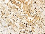 AGTPBP1 Antibody in Immunohistochemistry (Paraffin) (IHC (P))