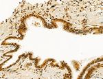 AGTPBP1 Antibody in Immunohistochemistry (Paraffin) (IHC (P))