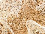 AGTPBP1 Antibody in Immunohistochemistry (Paraffin) (IHC (P))