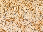 AGTPBP1 Antibody in Immunohistochemistry (Paraffin) (IHC (P))