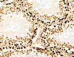 AGTPBP1 Antibody in Immunohistochemistry (Paraffin) (IHC (P))