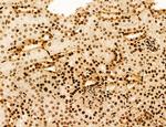 AGTPBP1 Antibody in Immunohistochemistry (Paraffin) (IHC (P))