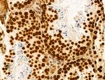 AGTPBP1 Antibody in Immunohistochemistry (Paraffin) (IHC (P))