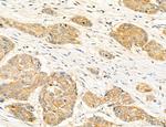 AGTPBP1 Antibody in Immunohistochemistry (Paraffin) (IHC (P))