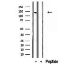 AGTPBP1 Antibody in Western Blot (WB)