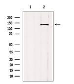 AGTPBP1 Antibody in Western Blot (WB)