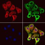 IFT25 Antibody in Immunocytochemistry (ICC/IF)