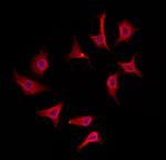 IFT25 Antibody in Immunocytochemistry (ICC/IF)